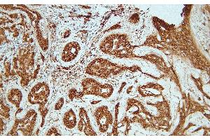 Immunohistochemistry (IHC) image for anti-Cadherin 1, Type 1, E-Cadherin (Epithelial) (CDH1) (C-Term) antibody (ABIN7598898)