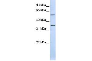 TJAP1 antibody used at 1 ug/ml to detect target protein. (TJAP1 anticorps)
