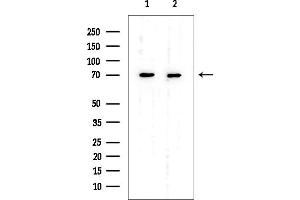 anti-Taurine Transporter (TAUT) (C-Term) antibody