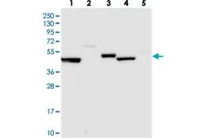 Western blot analysis of Lane 1: RT-4, Lane 2: U-251 MG, Lane 3: Human Plasma, Lane 4: Liver, Lane 5: Tonsil with UAP1L1 polyclonal antibody  at 1:250-1:500 dilution. (UAP1L1 anticorps)