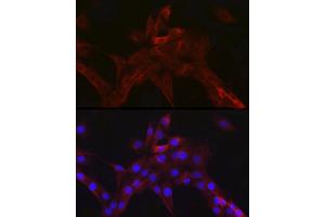 Immunofluorescence analysis of PC-12 cells using nNOS Rabbit mAb (ABIN1680436, ABIN1680435, ABIN7101483 and ABIN7101484) at dilution of 1:100 (40x lens). (NOS1 anticorps)