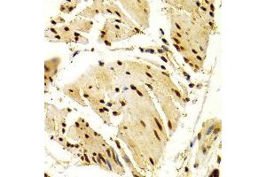 Immunohistochemistry of paraffin-embedded Human esophageal using NFATC1 antibody at dilution of 1:100 (x400 lens). (NFATC1 anticorps  (AA 20-300))