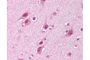 Anti-HUWE1 antibody IHC of human brain, cortex.