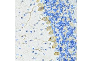 Immunohistochemistry of paraffin-embedded Mouse brain using Nestin antibody (ABIN6128335, ABIN6144536, ABIN6144537 and ABIN6215496) at dilution of 100 (40x lens).