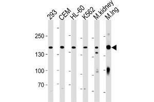 Western Blotting (WB) image for anti-Plakophilin 4 (PKP4) antibody (ABIN3004661) (Plakophilin 4 anticorps)