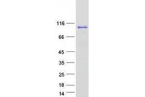 Validation with Western Blot