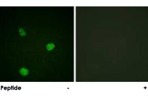 Immunofluorescence analysis of HeLa cells, using MITF polyclonal antibody . (MITF anticorps  (Ser73, Ser180))