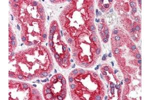 Human Kidney (formalin-fixed, paraffin-embedded) stained with CPT1A antibody at 4 µg/ml followed by biotinylated anti-goat IgG secondary antibody, alkaline phosphatase-streptavidin and chromogen. (CPT1A anticorps  (Internal Region))