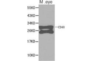 Western Blotting (WB) image for anti-CD40 (CD40) antibody (ABIN1871634) (CD40 anticorps)