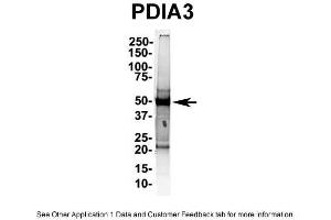 IP Suggested AntiPDIA3 Antibody Positive Control: NT2 CELL/BRAIN TISSUE (PDIA3 anticorps  (C-Term))