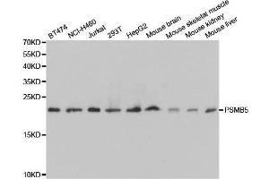 Western blot analysis of extracts of various cell lines, using PSMB5 antibody.
