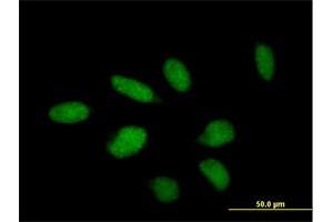 Immunofluorescence of purified MaxPab antibody to TTC23 on HeLa cell. (TTC23 anticorps  (AA 1-393))