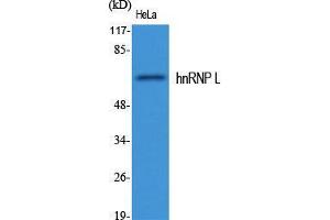 Western Blot (WB) analysis of specific cells using hnRNP L Polyclonal Antibody.