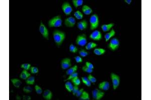 Immunofluorescence staining of Hela cells with ABIN7158207 at 1:166, counter-stained with DAPI. (LRIG2 anticorps  (AA 833-932))