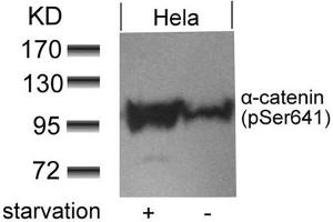 Western blot analysis of extracts from Hela cells untreated or treated with starvation using a-catenin(Phospho-Ser641) antibody. (CTNNA1 anticorps  (pSer641))