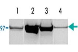 (1) Rat liver homogenate (50 ug of total protein). (PYGM anticorps)