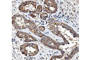 IHC analysis of EGFR using anti-EGFR antibody (ABIN7601478).