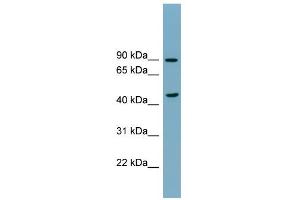 WB Suggested Anti-SMPD2 Antibody Titration:  0. (SMPD2 anticorps  (N-Term))
