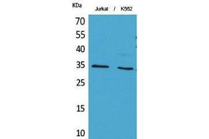 Western Blot (WB) analysis of Jurkat, K562 cells using Acetyl-Ref-1 (K7) Polyclonal Antibody. (APEX1 anticorps  (acLys7))