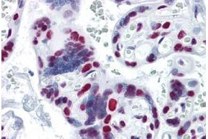 Human Placenta: Formalin-Fixed, Paraffin-Embedded (FFPE)