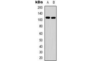 Western blot analysis of EPHA1 expression in Hela (A), HepG2 (B) whole cell lysates. (EPHA1 anticorps)