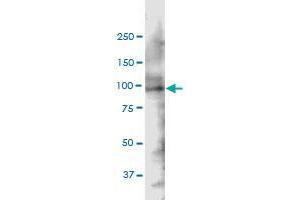 SH3KBP1 monoclonal antibody (M01), clone 1F11. (SH3KBP1 anticorps  (AA 224-308))