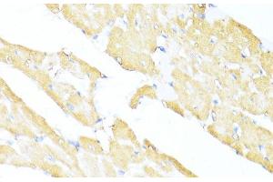 Immunohistochemistry of paraffin-embedded Rat heart using UQCC2 Polyclonal Antibody at dilution of 1:100 (40x lens). (MNF1 anticorps)