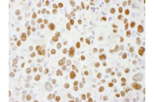 Immunohistochemistry (IHC) image for anti-Sp1 Transcription Factor (SP1) (AA 735-785) antibody (ABIN7453450)