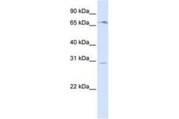 OR6C75 anticorps  (C-Term)