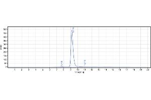 anti-TNFRSF10B (Conatumumab Biosimilar) antibody