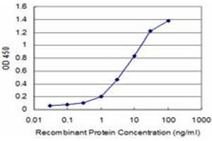 Detection limit for recombinant GST tagged HOXB7 is approximately 0. (HOXB7 anticorps  (AA 55-120))