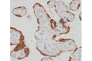 Immunohistochemistry of paraffin-embedded Human placenta using SARS2 Polyclonal Antibody at dilution of 1:100 (40x lens). (SARS2 anticorps)