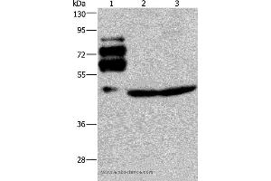 Western blot analysis of Human rectal cancer tissue, Jurkat and HT-29 cell, using PCSK9 Polyclonal Antibody at dilution of 1:200 (PCSK9 anticorps)