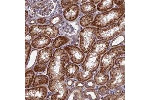 Immunohistochemical staining of human kidney with KIAA1468 polyclonal antibody  shows strong cytoplasmic positivity in cells in tubules. (KIAA1468 anticorps)