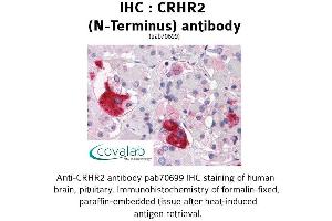 Image no. 1 for anti-Corticotropin Releasing Hormone Receptor 2 (CRHR2) (Extracellular Domain), (N-Term) antibody (ABIN1733312) (CRHR2 anticorps  (Extracellular Domain, N-Term))