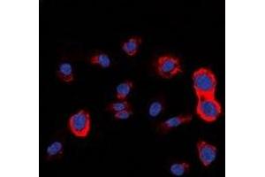 Immunofluorescent analysis of HER2 staining in HepG2 cells. (ErbB2/Her2 anticorps)