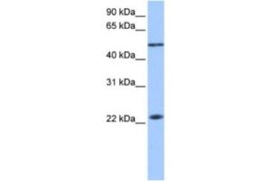 Western Blotting (WB) image for anti-Protein Inhibitor of Activated STAT, 2 (PIAS2) antibody (ABIN2463619) (PIAS2 anticorps)