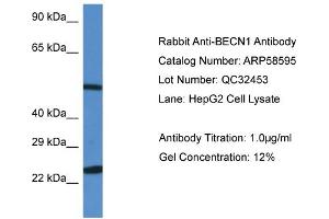 WB Suggested Anti-BECN1 Antibody Titration: 0. (Beclin 1 anticorps  (N-Term))