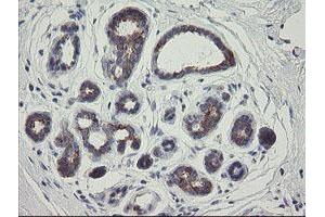 anti-RIO Kinase 2 (RIOK2) (AA 277-552) antibody