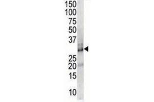 DSCR1 antibody used in western blot to detect DSCR1 in endothelial cell lysate (RCAN1 anticorps  (AA 75-104))