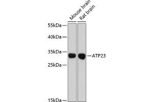 Western blot analysis of extracts of various cell lines, using  antibody (ABIN6127790, ABIN6137312, ABIN6137313 and ABIN6216681) at 1:3000 dilution. (XRCC6BP1 anticorps  (AA 1-246))