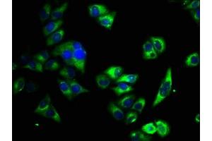 Immunofluorescence staining of Hela cells with ABIN7163520 at 1:33, counter-stained with DAPI. (ATP2B4 anticorps  (AA 281-345))
