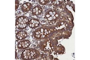 Immunohistochemical staining of human colon with FILIP1L polyclonal antibody  shows strong cytoplasmic positivity in glandular cells.