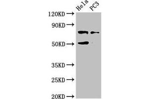 Western Blot Positive WB detected in: Hela whole cell lysate, PC-3 whole cell lysate All lanes: GLB1 antibody at 4 μg/mL Secondary Goat polyclonal to rabbit IgG at 1/50000 dilution Predicted band size: 77, 61, 73 kDa Observed band size: 77 kDa