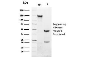 SDS-PAGE Analysis Purified NKX3.