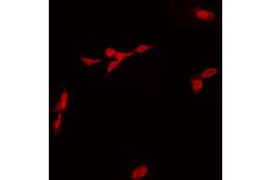 ABIN6268765 staining Hela by IF/ICC. (SOX6 anticorps  (N-Term))