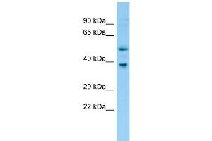 WB Suggested Anti-Fntb Antibody Titration: 1.