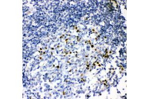 Anti- MUM1 antibody, IHC(P) IHC(P): Human Tonsil Tissue (IRF4 anticorps  (AA 272-451))