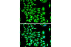 Immunofluorescence analysis of A549 cells using TREX1 antibody.