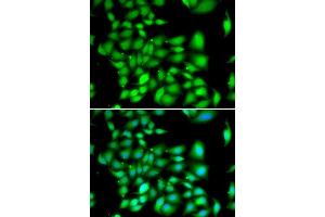 Immunofluorescence analysis of A549 cells using TREX1 antibody. (TREX1 anticorps  (AA 1-270))